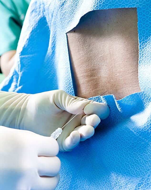 epidural-injections-FDA-warning - Orange County Disc Associates®